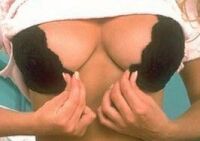 Natural Breast Enhancement System